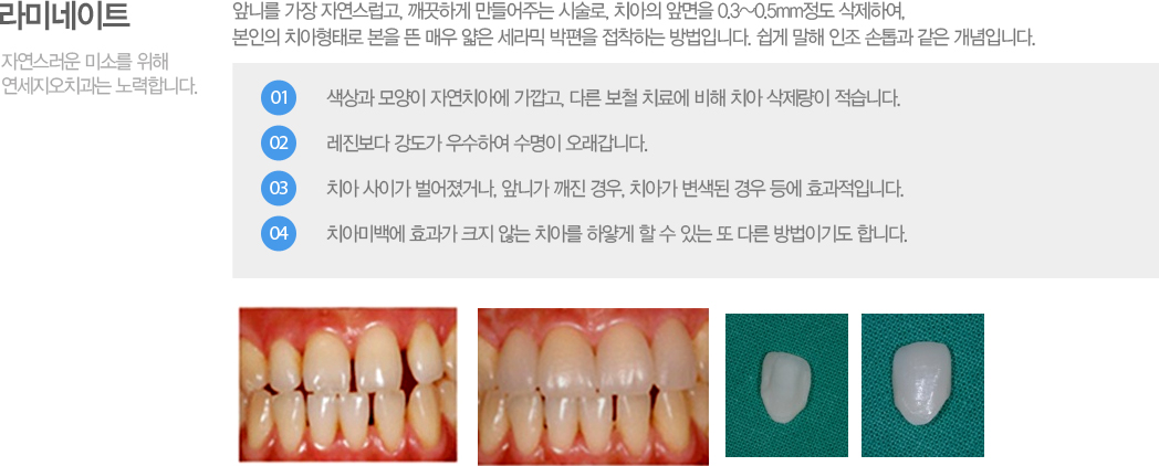 ̳Ʈ
մϸ  ڿ, ϰ ִ ü, ġ ո 0.3~0.5mm Ͽ,  ġ·   ſ    ϴ Դϴ.      Դϴ. 
  ڿġƿ , ٸ ö ġῡ  ġ  ϴ.   캸  Ͽ  ϴ.
ġ ̰ ų, մϰ  , ġư    ȿ̸, 
ġƹ̹鿡 ȿ ũ ʴ ġƸ Ͼ   ִ  ٸ ̱⵵ մϴ. 